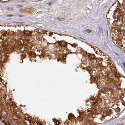 Immunohistochemistry-Paraffin: Hsp70 interacting protein HIP Antibody [NBP2-47427]