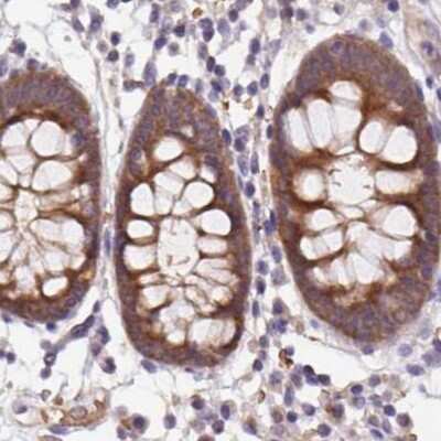 Immunohistochemistry-Paraffin: Hsp70 interacting protein HIP Antibody [NBP2-47427]