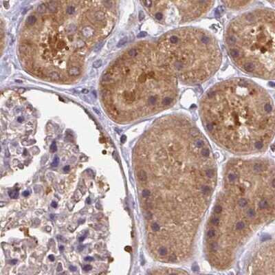 Immunohistochemistry-Paraffin: Hsp70 interacting protein HIP Antibody [NBP2-47427]