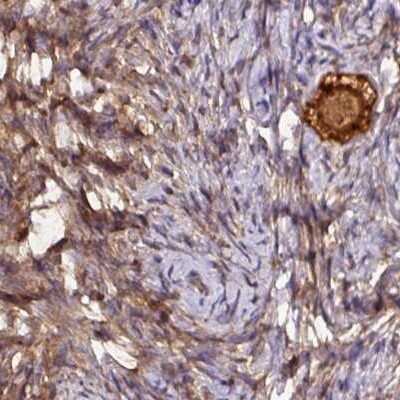Immunohistochemistry-Paraffin: Hsp70 interacting protein HIP Antibody [NBP2-47427]