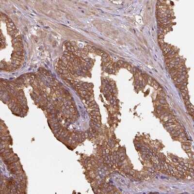 Immunohistochemistry-Paraffin: Hsp70 interacting protein HIP Antibody [NBP2-48786]
