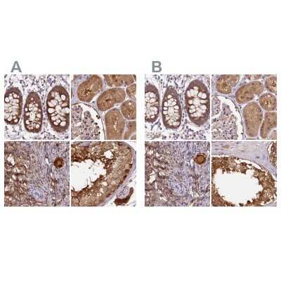 Immunohistochemistry-Paraffin: Hsp70 interacting protein HIP Antibody [NBP2-48786]