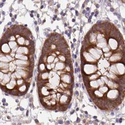 Immunohistochemistry-Paraffin: Hsp70 interacting protein HIP Antibody [NBP2-48786]