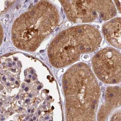 Immunohistochemistry-Paraffin: Hsp70 interacting protein HIP Antibody [NBP2-48786]
