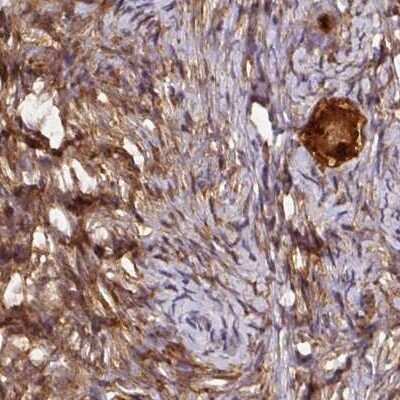 Immunohistochemistry-Paraffin: Hsp70 interacting protein HIP Antibody [NBP2-48786]