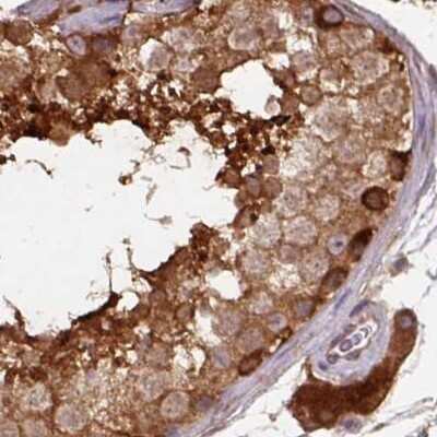 Immunohistochemistry-Paraffin: Hsp70 interacting protein HIP Antibody [NBP2-48786]