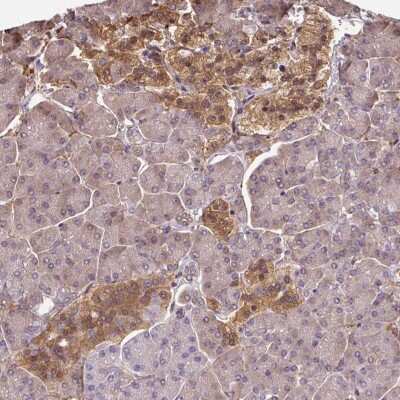 Immunohistochemistry-Paraffin: Hsp70 interacting protein HIP Antibody [NBP2-48865]