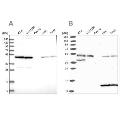 Western Blot: Hsp70 interacting protein HIP Antibody [NBP2-48866]