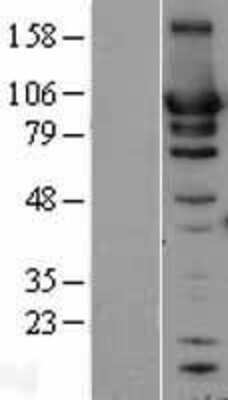 Western Blot: HSP90 beta Overexpression Lysate [NBL1-11745]