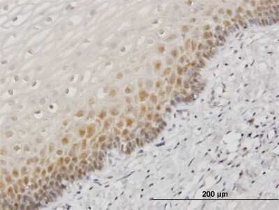 Immunohistochemistry-Paraffin: HspA1B Antibody (2D11) [H00003304-M05]