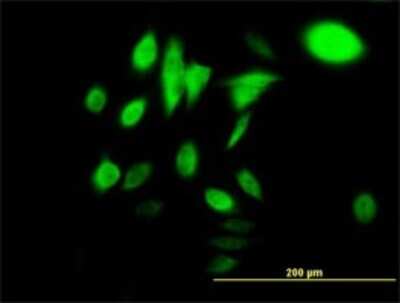 Immunocytochemistry/ Immunofluorescence: HspA1B Antibody (3B7) [H00003304-M02]