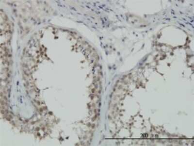 Immunohistochemistry-Paraffin: HspA1B Antibody (3B7) [H00003304-M02]