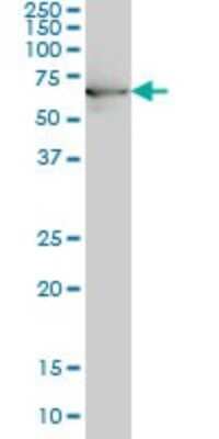Western Blot: HspA1B Antibody (3B7) [H00003304-M02]