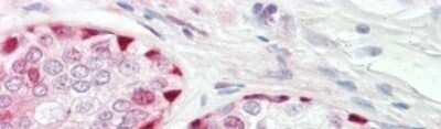 Immunohistochemistry: HspA1B Antibody [NBP1-98547]