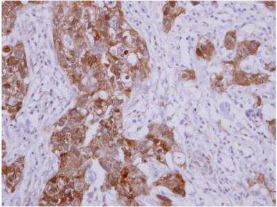 Immunohistochemistry-Paraffin: HspA1B Antibody [NBP2-16896]