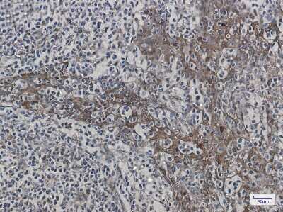 Immunohistochemistry-Paraffin: HspA1B Antibody (S07-6E9) [NBP3-15044]