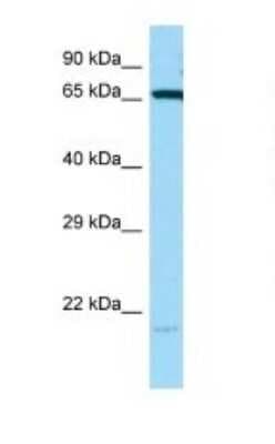 Western Blot: HspA1B Antibody [NBP1-98547]