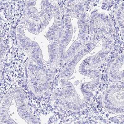Immunohistochemistry-Paraffin: HspA1L Antibody [NBP1-92012]