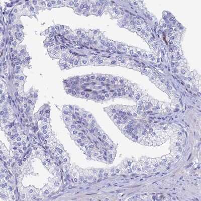 Immunohistochemistry-Paraffin: HspA1L Antibody [NBP1-92012]