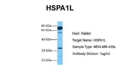 Western Blot: HspA1L Antibody [NBP1-56938]