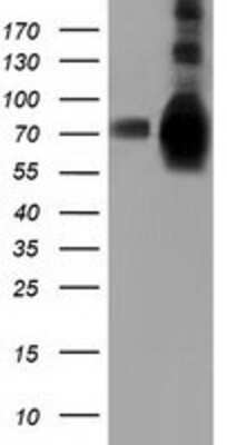 Western Blot: HspA6 Antibody (OTI1H3) [NBP2-03076]