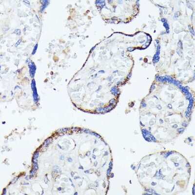 Immunohistochemistry-Paraffin: HspB11 Antibody - Azide and BSA Free [NBP2-94113]