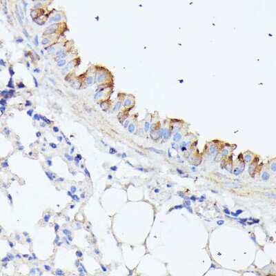 Immunohistochemistry-Paraffin: HspB11 Antibody - Azide and BSA Free [NBP2-94113]
