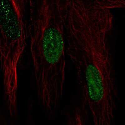 Immunocytochemistry/ Immunofluorescence: HspB7 Antibody [NBP1-84334]