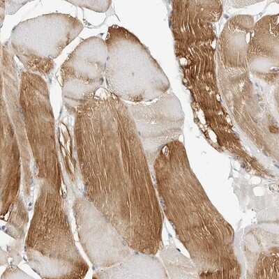 Immunohistochemistry-Paraffin: HspB7 Antibody [NBP1-84334]