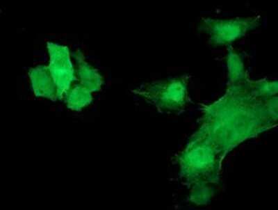 Immunocytochemistry/ Immunofluorescence: HspB7 Antibody (OTI1D11) - Azide and BSA Free [NBP2-71833]