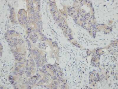 Immunohistochemistry-Paraffin: HspBAP1 Antibody [NBP2-16900]