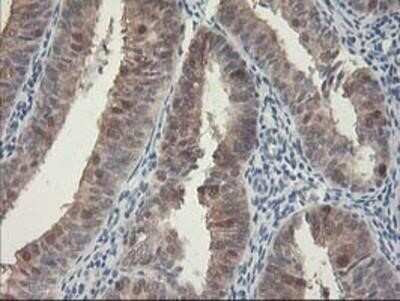 Immunohistochemistry: HspBP1 Antibody (OTI1D5) - Azide and BSA Free [NBP2-71761]