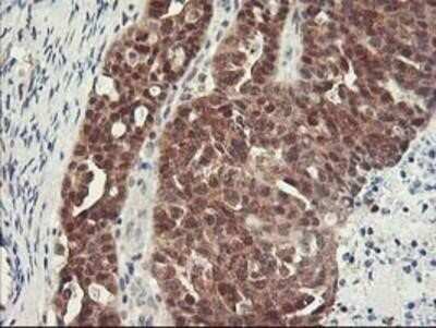 Immunohistochemistry: HspBP1 Antibody (OTI1D5) - Azide and BSA Free [NBP2-71761]