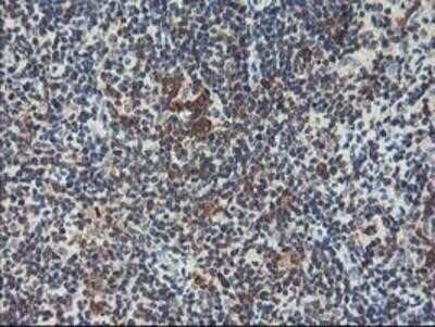 Immunohistochemistry: HspBP1 Antibody (OTI1D5) - Azide and BSA Free [NBP2-71761]