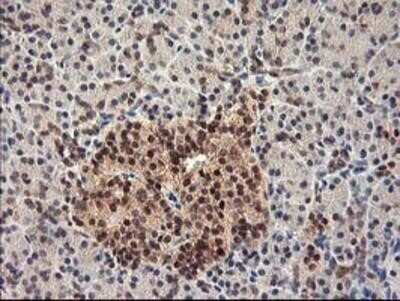 Immunohistochemistry: HspBP1 Antibody (OTI1D5) - Azide and BSA Free [NBP2-71761]