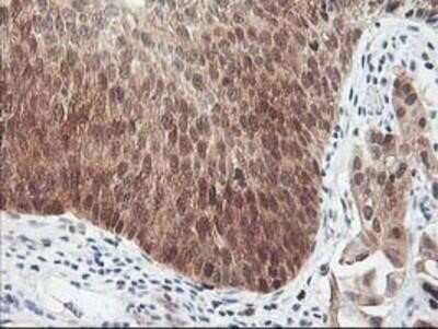 Immunohistochemistry-Paraffin: HspBP1 Antibody (OTI1D5) [NBP2-01168]
