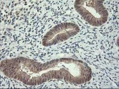 Immunohistochemistry-Paraffin: HspBP1 Antibody (OTI1D5) [NBP2-01168]