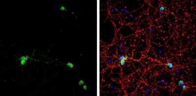 Immunocytochemistry/ Immunofluorescence: HuC Antibody [NBP3-13367]