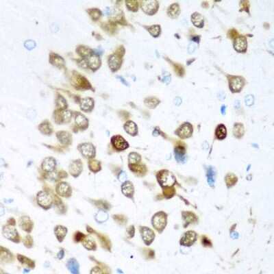 Immunohistochemistry-Paraffin: HuC Antibody - Azide and BSA Free [NBP3-02943]
