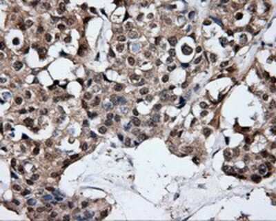 Immunohistochemistry-Paraffin: HuR/ELAVL1 Antibody (OTI14F4) [NBP2-02287]