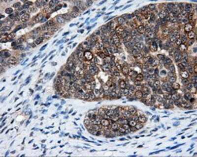 Immunohistochemistry-Paraffin: HuR/ELAVL1 Antibody (OTI14F4) [NBP2-02287]