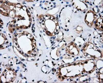 Immunohistochemistry-Paraffin: HuR/ELAVL1 Antibody (OTI14F4) [NBP2-02287]