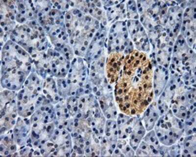 Immunohistochemistry-Paraffin: HuR/ELAVL1 Antibody (OTI14F4) [NBP2-02287]