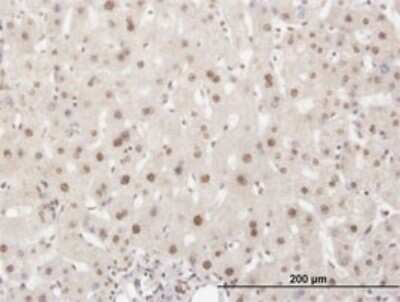 Immunohistochemistry-Paraffin: HuR/ELAVL1 Antibody (4G8) [H00001994-M02]