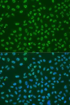 Immunocytochemistry/ Immunofluorescence: HuR/ELAVL1 Antibody - BSA Free [NBP3-02947]