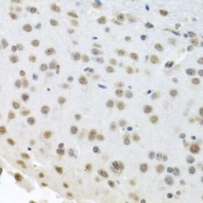 Immunohistochemistry-Paraffin: HuR/ELAVL1 Antibody - BSA Free [NBP3-02947]