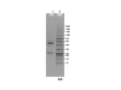 SDS-PAGE: Human IgG Isotype Control [NBP1-97043]