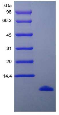 SDS-PAGE: Recombinant Human CCL15/MIP-1 delta Protein [NBP2-35043]