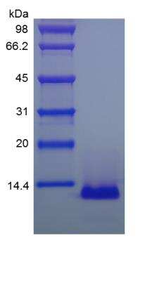 SDS-PAGE: Recombinant Human CCL26/Eotaxin-3 Protein [NBP2-34982]