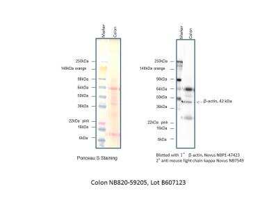 Western Blot: Human Colon Whole Tissue Lysate (Adult Whole Normal) [NB820-59205]